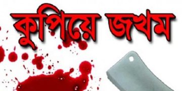 বৃদ্ধ শ্বশুরকে কুপিয়ে গুরুতর জখম 