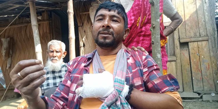 লোহাগড়ায় ভাঙ্গারি ব্যবসায়ী ককটেল বিস্ফোরণে গুরুতর আহত