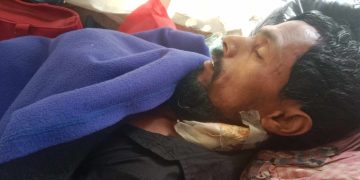 ফরিদপুরের সালথায় জমিজমা নিয়ে কুপিয়ে আহত করায় হাসপাতালে ভর্তি