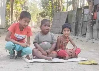 ৩২ বছর বয়স হলেও দেখতে শিশুর মতো।