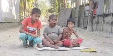 ৩২ বছর বয়স হলেও দেখতে শিশুর মতো।