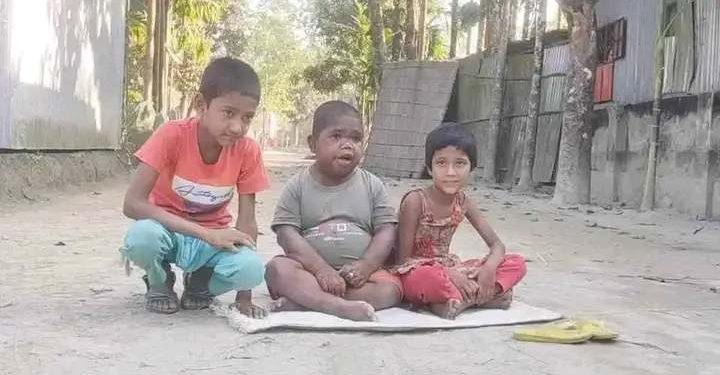 ৩২ বছর বয়স হলেও দেখতে শিশুর মতো।