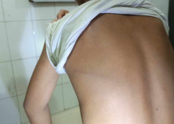 পটুয়াখালী বাউফলে আইসক্রিম চুরির অপবাদে ৩শিশুকে শিকলে বেঁধে নির্যাতন