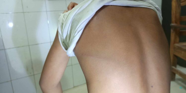 পটুয়াখালী বাউফলে আইসক্রিম চুরির অপবাদে ৩শিশুকে শিকলে বেঁধে নির্যাতন