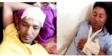 বাউফলে প্রতিপক্ষের হামলায় গুরুতর আহত ২