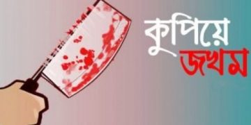 নির্বাচনী সহিংসতাই উপি সদস্যকে কুপিয়ে জখম।