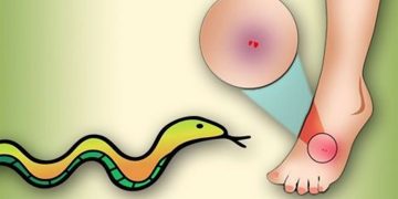 ধামরাইয়ে সাপের কামড়ে বৃদ্ধার মৃত্যু ।