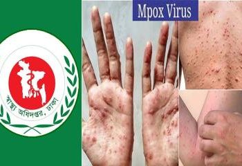 ‘মাঙ্কিপক্স’ সচেতনতায় হটলাইন চালু করল স্বাস্থ্য অধিদপ্তর।