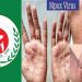‘মাঙ্কিপক্স’ সচেতনতায় হটলাইন চালু করল স্বাস্থ্য অধিদপ্তর।