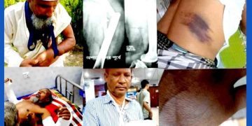 পারিবারিক কবরস্থান ঘিরাকে কেন্দ্র করে দুই পক্ষের সংঘর্ষে আওয়ামী লীগ নেতাসহ ,আহত-৩