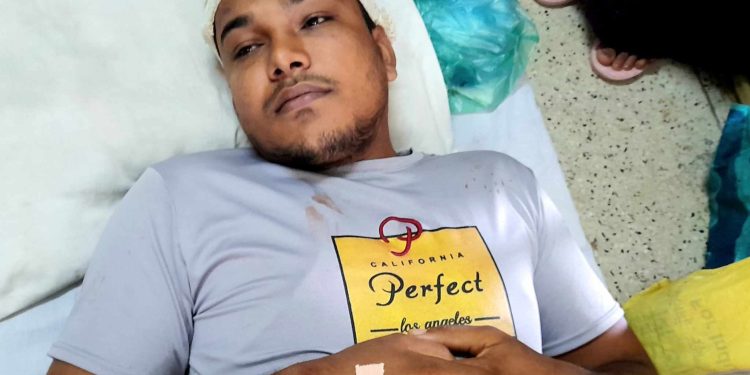 বাগেরহাটে রামপালে সন্ত্রাসী হামলায় ছাত্রদল নেতা তামিম আহত।