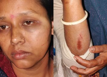 বাগেরহাটে বাবু সরদারের নেতৃত্বে সন্ত্রাসী হামলায় আহত ৪ নারী।