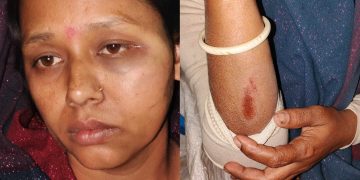 বাগেরহাটে বাবু সরদারের নেতৃত্বে সন্ত্রাসী হামলায় আহত ৪ নারী।