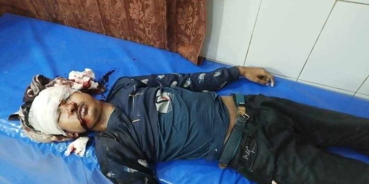 ভূঞাপুরে মোটরসাইকেল-অটোরিকশার সংঘর্ষে প্রাণ গেল এক কলেজছাত্রের।