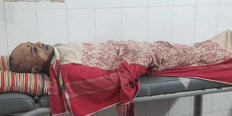 বাগেরহাটের কচুয়ায় প্রতিপক্ষের হামলায় নিহত -১ আহত ৭ 