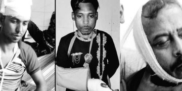 রামপালে আওয়ামী সন্ত্রাসীদের হামলায় বিএনপি ছাত্রদলের ৪ নেতা-কর্মী আহতের ঘটনায় মামলা।