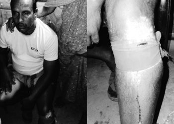 বাগেরহাটের রামপালে আধিপত্য বিস্তারকে কেন্দ্র করে দুই গ্রুপের সংঘর্ষ আহত- ২