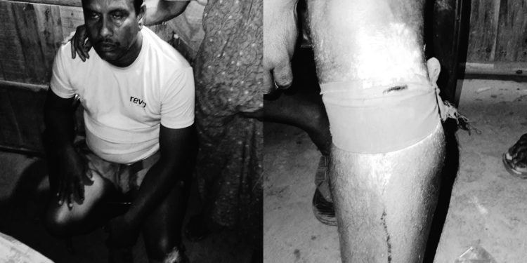 বাগেরহাটের রামপালে আধিপত্য বিস্তারকে কেন্দ্র করে দুই গ্রুপের সংঘর্ষ আহত- ২