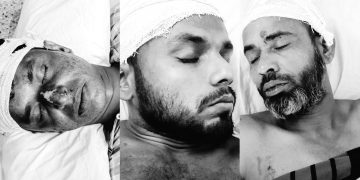 বাগেরহাটে রামপালে পূর্ব শত্রুতার জেরে উভয় পক্ষের ৩ যুবক আহত।