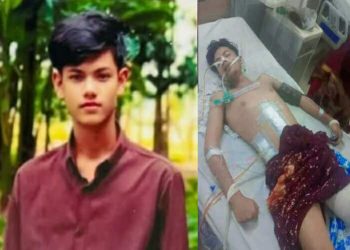 জামালপুরের মাদারগঞ্জেজীবন যুদ্ধে হেরে গেলেন  সড়কদূর্ঘটনায় পা হারানো নাঈম।