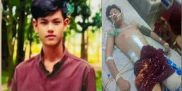 জামালপুরের মাদারগঞ্জেজীবন যুদ্ধে হেরে গেলেন  সড়কদূর্ঘটনায় পা হারানো নাঈম।