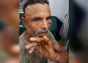 লেনদেন সম্পর্কিত আপোষ মিমাংসার বিচারে মারধরের অভিযোগ।