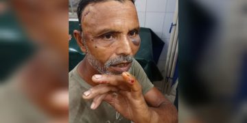 লেনদেন সম্পর্কিত আপোষ মিমাংসার বিচারে মারধরের অভিযোগ।