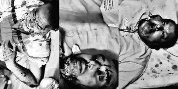 টাঙ্গাইলে এমপি গ্রুপের হামলায় বিএনপির চার নেতাকর্মী আহত।