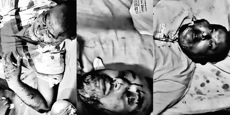 টাঙ্গাইলে এমপি গ্রুপের হামলায় বিএনপির চার নেতাকর্মী আহত।